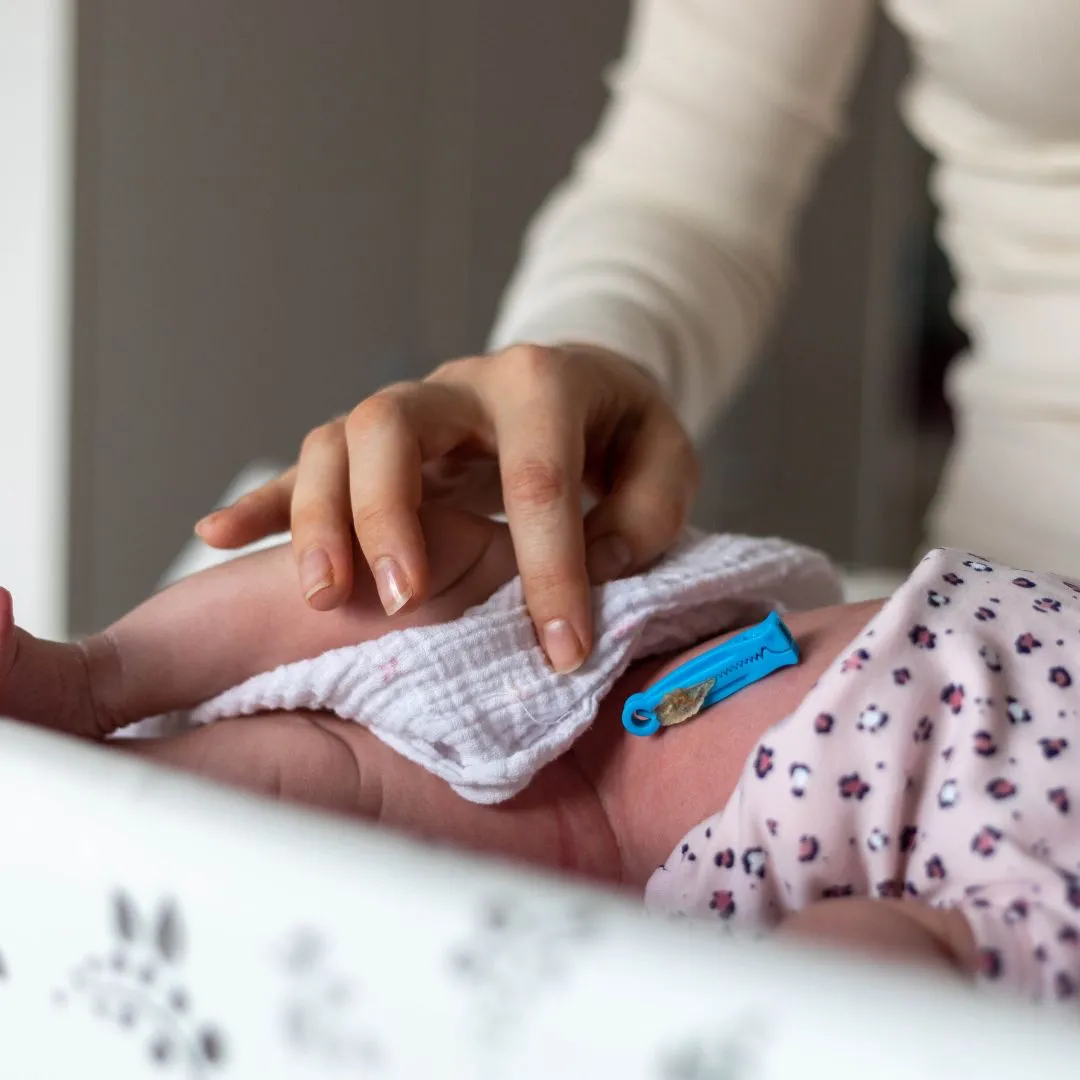 A Guide to Umbilical Cord Hygiene