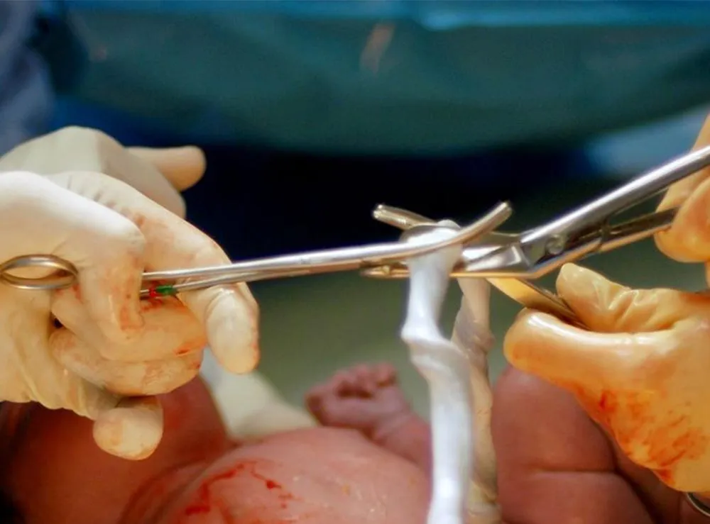 Delayed Cord Clamping & Banking